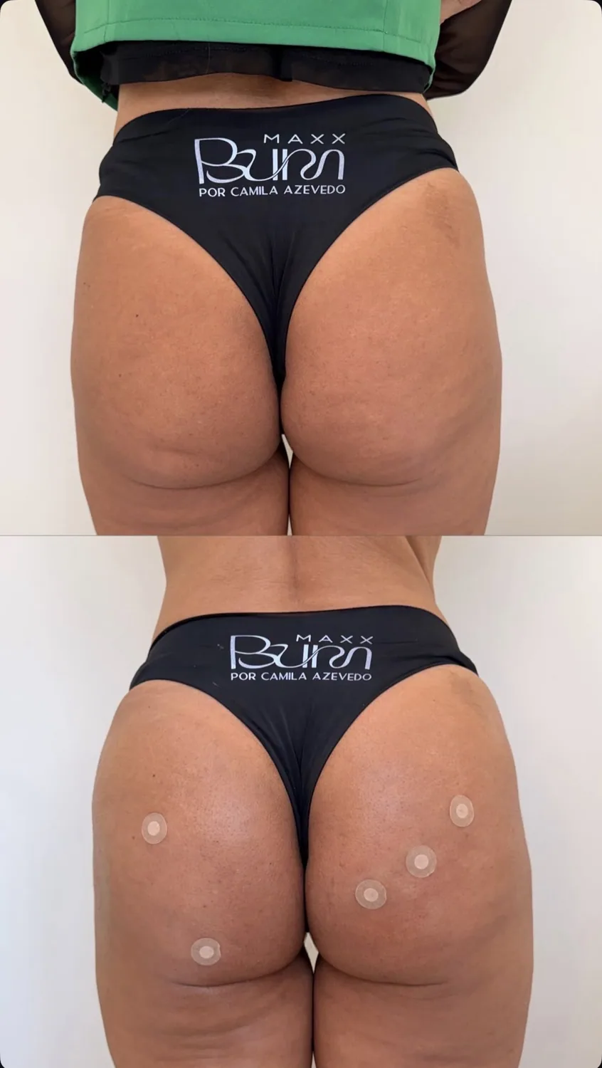 Comparação clínica de antes e depois
