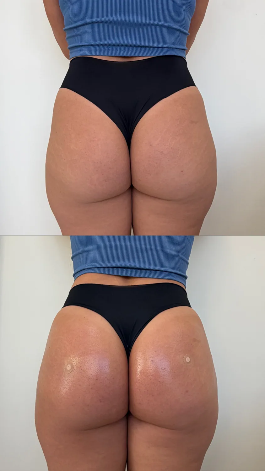 Comparação clínica de antes e depois