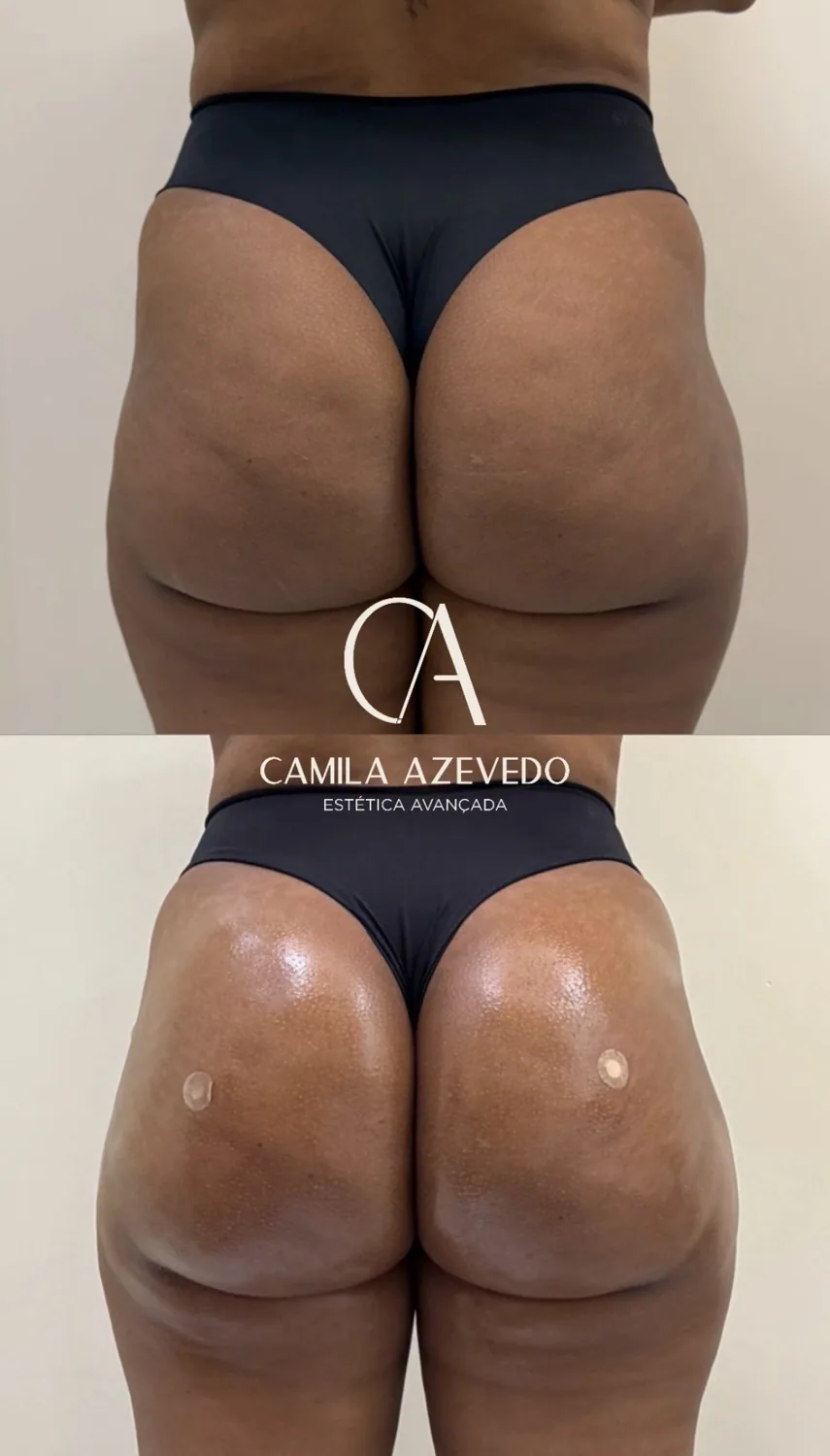 Comparação de resultado MaxxBum