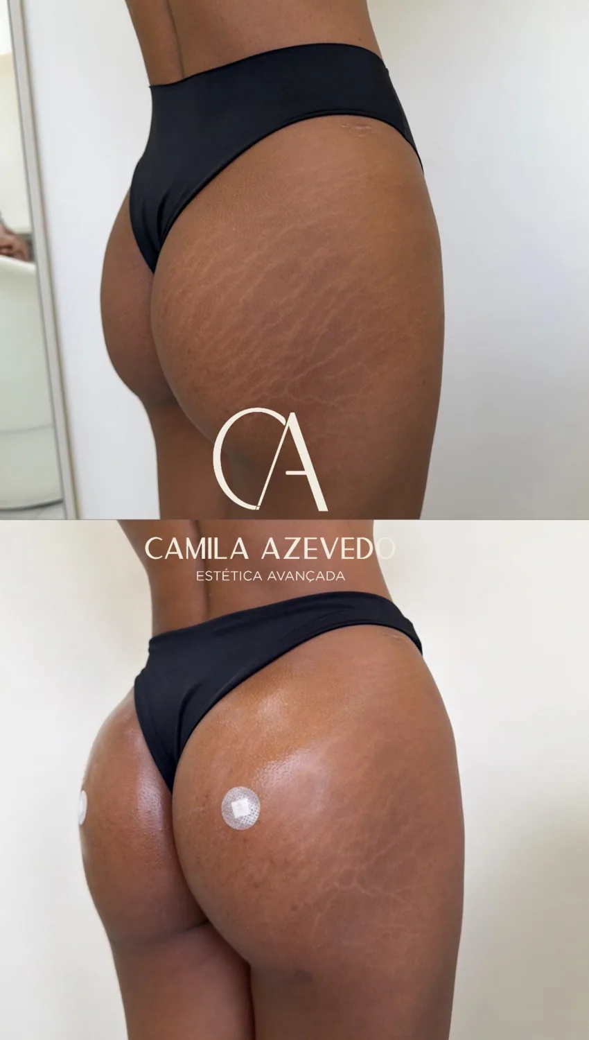 Comparação de resultado MaxxBum